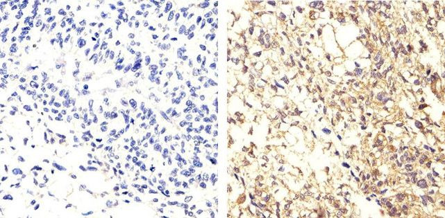 Phospho-EGFR (Tyr1068) Antibody in Immunohistochemistry (Paraffin) (IHC (P))