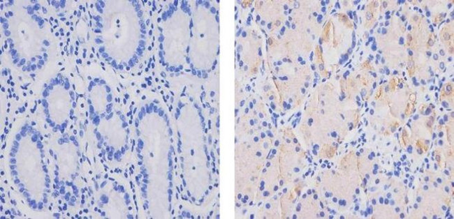 MCP-2 Antibody in Immunohistochemistry (Paraffin) (IHC (P))