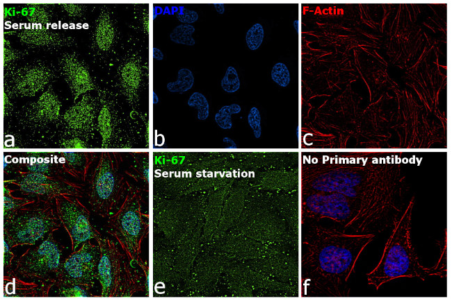 Ki-67 Antibody in Immunocytochemistry (ICC/IF)