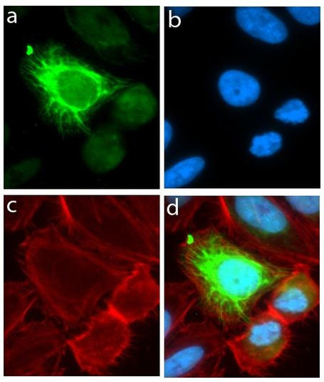 MSI1 Antibody in Immunocytochemistry (ICC/IF)