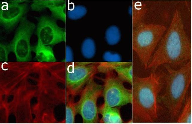 Phospho-S6 (Ser235, Ser236) Antibody in Immunocytochemistry (ICC/IF)