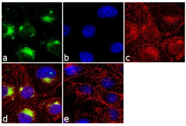 SHH Antibody in Immunocytochemistry (ICC/IF)