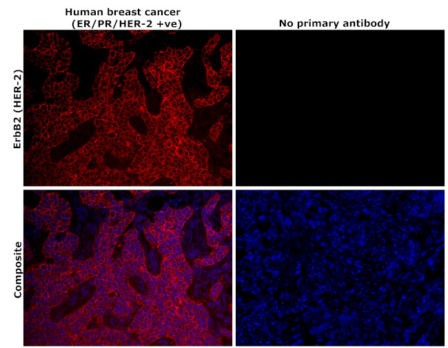 ErbB2 (HER-2) Antibody in Immunohistochemistry (Paraffin) (IHC (P))