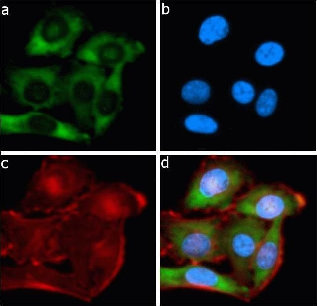 Bcl-2 Antibody in Immunocytochemistry (ICC/IF)