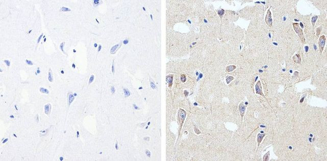 Phospho-Tau (Thr181) Antibody in Immunohistochemistry (Paraffin) (IHC (P))