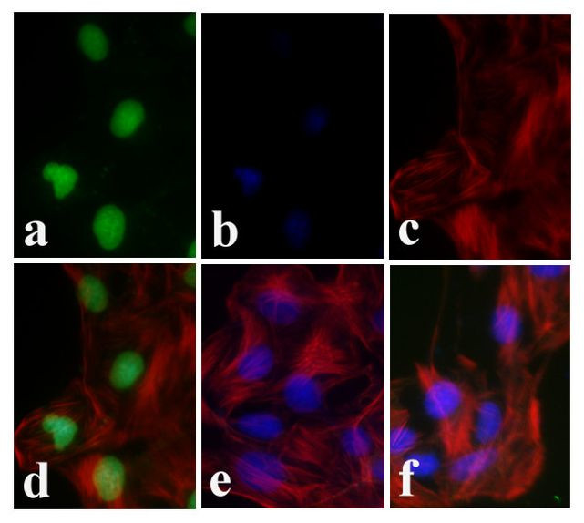 Phospho-FOXA2 (Thr156) Antibody in Immunocytochemistry (ICC/IF)