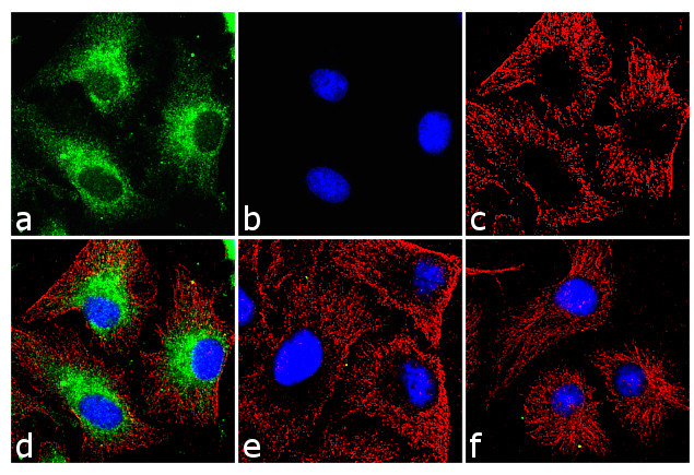 BNIP3 Antibody in Immunocytochemistry (ICC/IF)