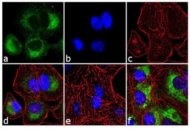 Phospho-SMAD3 (Ser423, Ser425) Antibody in Immunocytochemistry (ICC/IF)