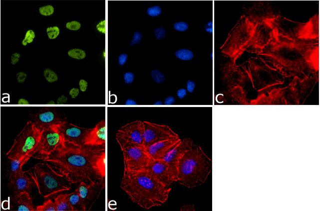 EKLF Antibody in Immunocytochemistry (ICC/IF)