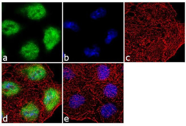 KLF5 Antibody in Immunocytochemistry (ICC/IF)