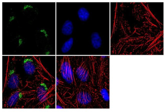 Spectrin beta-3 Antibody in Immunocytochemistry (ICC/IF)