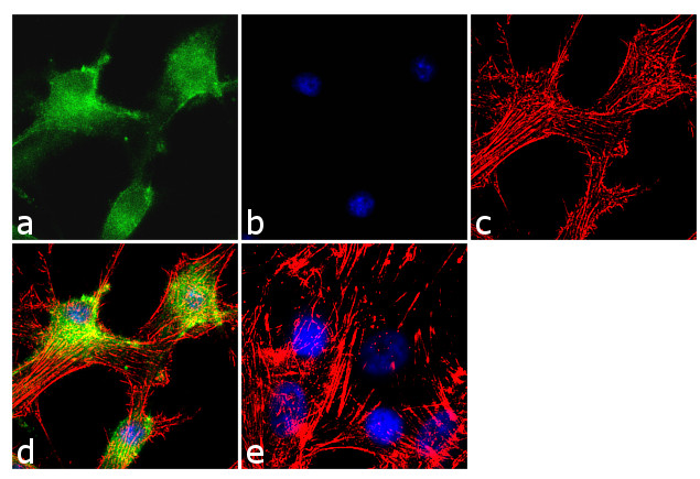 NOTCH2 Antibody in Immunocytochemistry (ICC/IF)