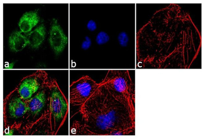 Stathmin 1 Antibody in Immunocytochemistry (ICC/IF)