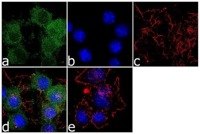 SSTR2 Antibody in Immunocytochemistry (ICC/IF)