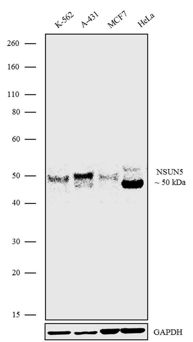 NSUN5 Antibody in Western Blot (WB)