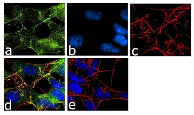 SLC6A4 Antibody in Immunocytochemistry (ICC/IF)