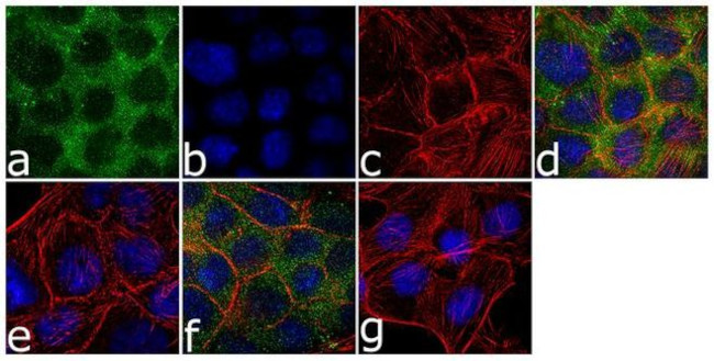 Phospho-WEE1 (Ser642) Antibody in Immunocytochemistry (ICC/IF)