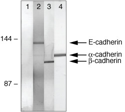alpha Catenin Antibody in Immunoprecipitation (IP)