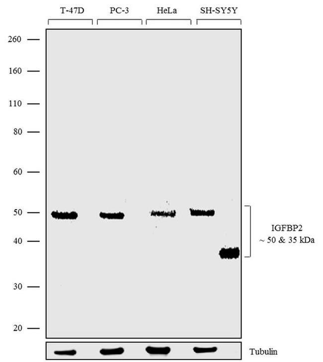 IGFBP2 Antibody in Western Blot (WB)