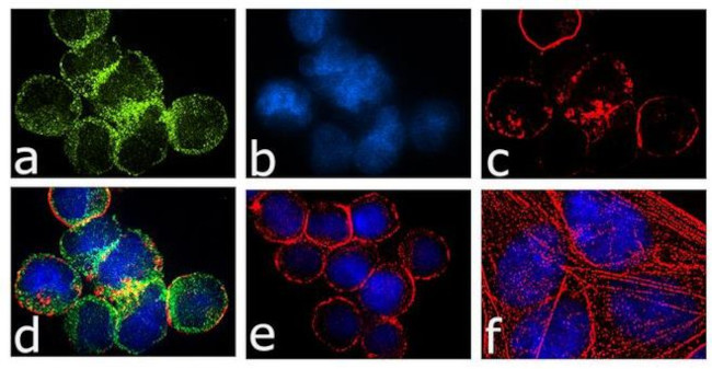 CCR1 Antibody in Immunocytochemistry (ICC/IF)