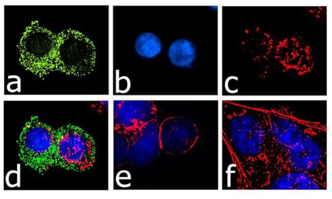 CCR3 Antibody in Immunocytochemistry (ICC/IF)