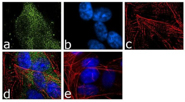 FMRP Antibody in Immunocytochemistry (ICC/IF)