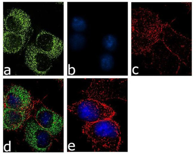 Calbindin D28K Antibody in Immunocytochemistry (ICC/IF)