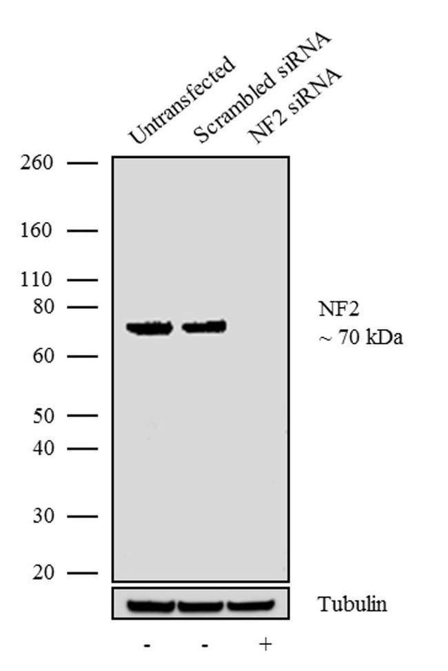 NF2 Antibody in Western Blot (WB)