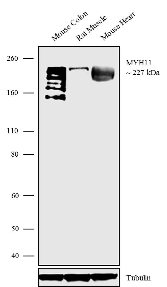 MYH11 Antibody in Western Blot (WB)