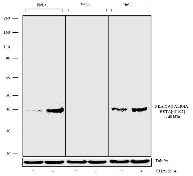 Phospho-PKA alpha/beta (Thr197) Antibody in Western Blot (WB)