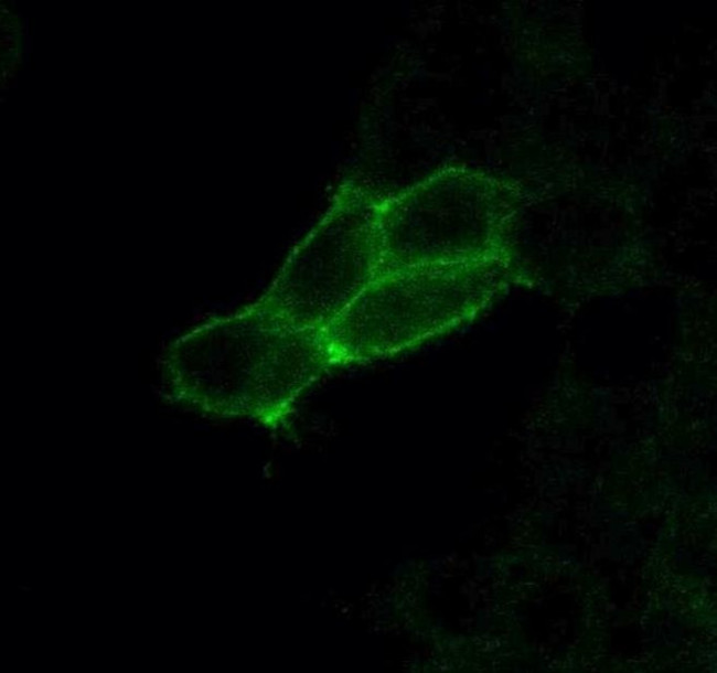 Calcitonin Receptor Antibody in Immunocytochemistry (ICC/IF)