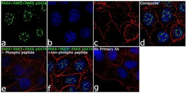 Phospho-PAK4/6/7 (Ser474) Antibody in Immunocytochemistry (ICC/IF)