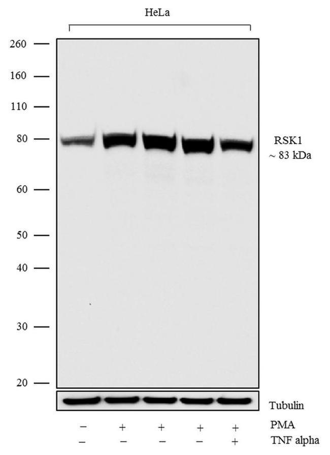 RSK1 Antibody in Western Blot (WB)