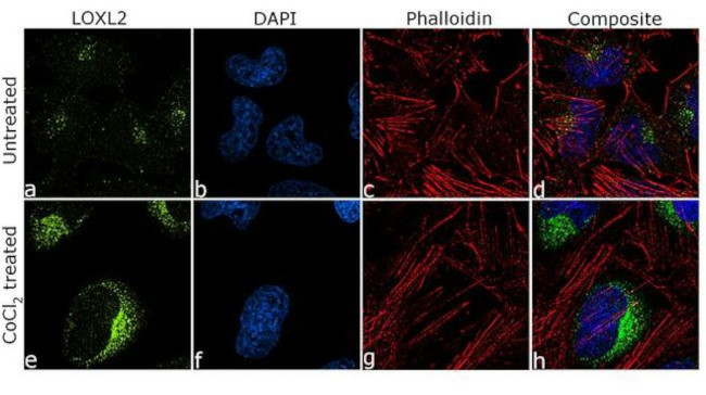 LOXL2 Antibody in Immunocytochemistry (ICC/IF)