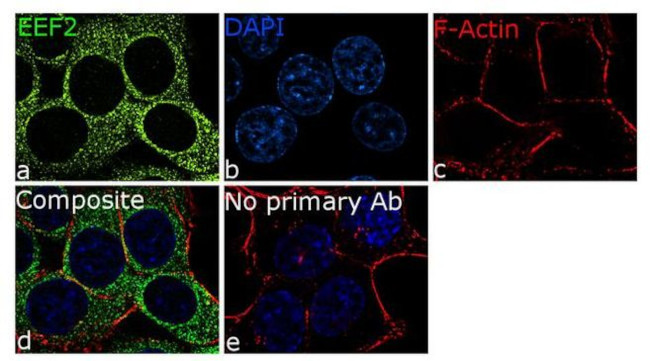 EEF2 Antibody in Immunocytochemistry (ICC/IF)
