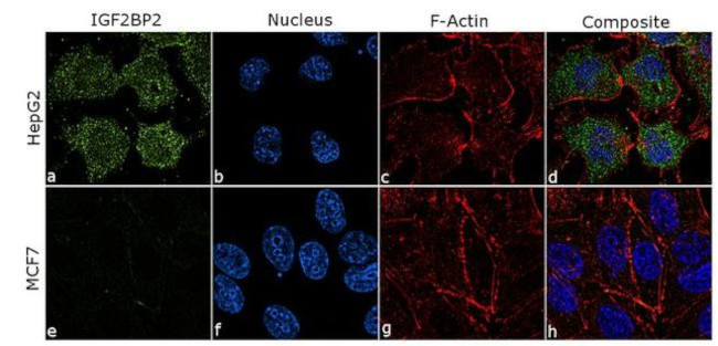 IGF2BP2 Antibody in Immunocytochemistry (ICC/IF)