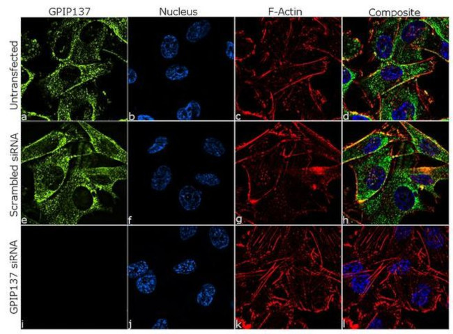 GPIP137 Antibody in Immunocytochemistry (ICC/IF)