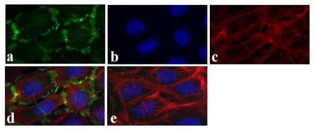 Connexin 30 Antibody in Immunocytochemistry (ICC/IF)