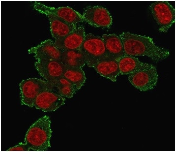 TNF-alpha (TumorNecrosis Factor alpha) Antibody in Immunocytochemistry (ICC/IF)