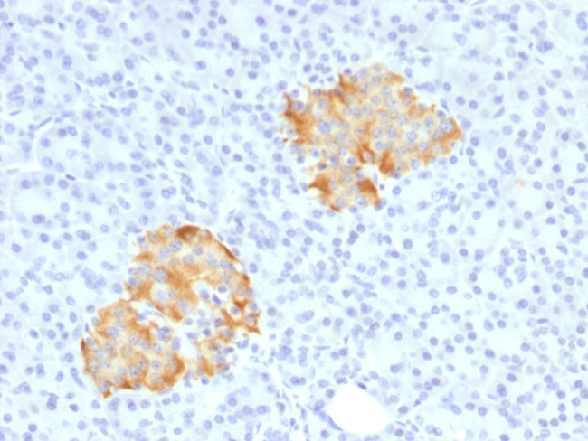 TNF-alpha (Tumor Necrosis Factor alpha) Antibody in Immunohistochemistry (Paraffin) (IHC (P))