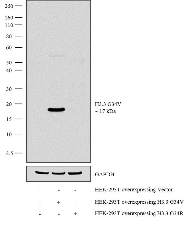 H3.3 G34V oncohistone mutant Antibody in Western Blot (WB)