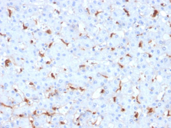 C1QB/Complement C1q B-Chain Antibody in Immunohistochemistry (Paraffin) (IHC (P))