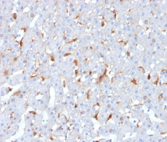 C1QB/Complement C1q B-Chain Antibody in Immunohistochemistry (Paraffin) (IHC (P))