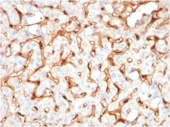 C1QB/Complement C1q B-Chain Antibody in Immunohistochemistry (Paraffin) (IHC (P))