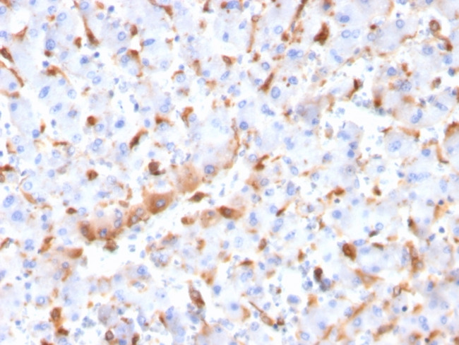 C1QB/Complement C1q B-Chain Antibody in Immunohistochemistry (Paraffin) (IHC (P))