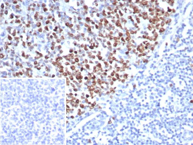 Topoisomerase II alpha (Proliferation and Drug-Resistance Marker) Antibody in Immunohistochemistry (Paraffin) (IHC (P))