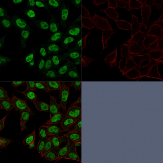 Topoisomerase II alpha Antibody in Immunocytochemistry (ICC/IF)