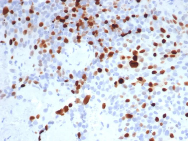 Topoisomerase II alpha (Proliferation and Drug-Resistance Marker) Antibody in Immunohistochemistry (Paraffin) (IHC (P))