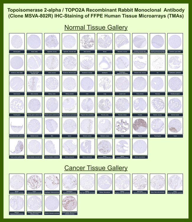 Topoisomerase II alpha (Proliferation & Drug-Resistance Marker) Antibody in Immunohistochemistry (Paraffin) (IHC (P))