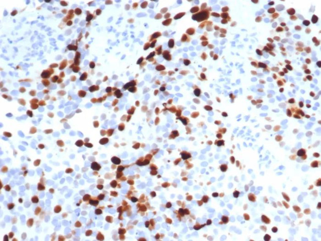 Topoisomerase II alpha (Proliferation and Drug-Resistance Marker) Antibody in Immunohistochemistry (Paraffin) (IHC (P))